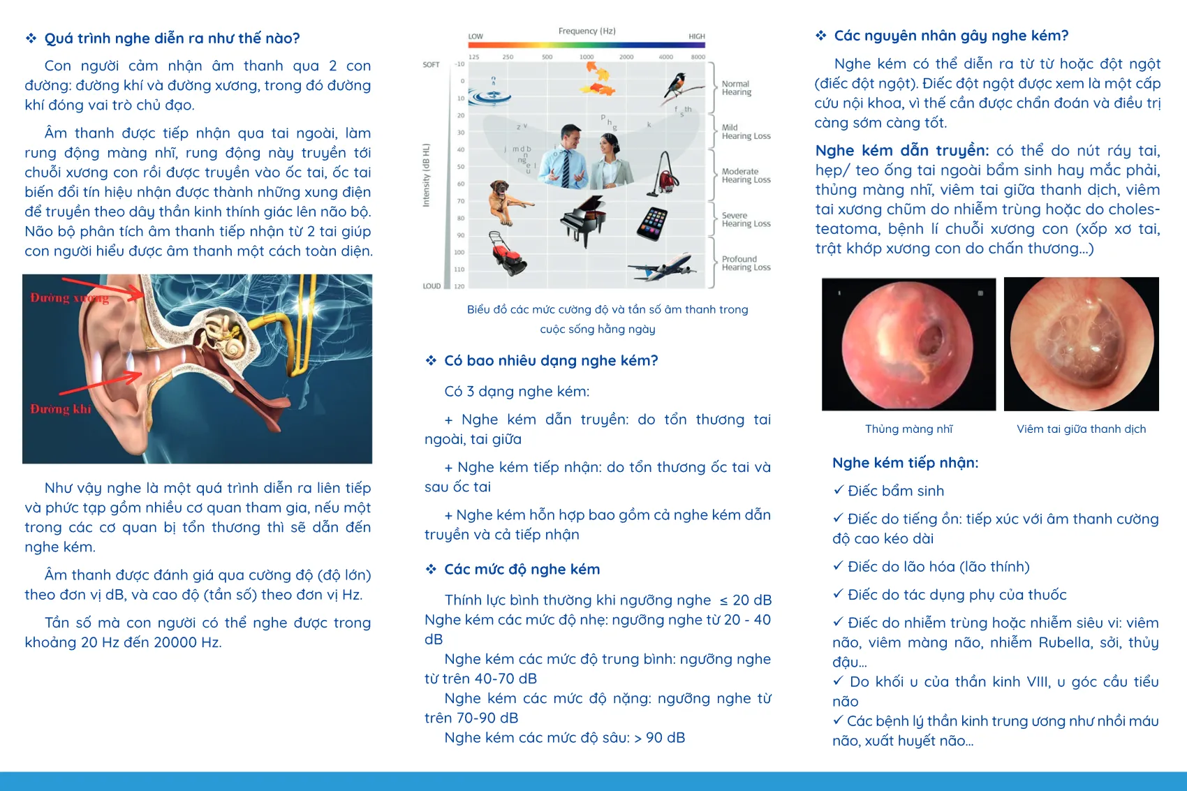 to roi nghe kem va nhung dieu can biet_2.webp